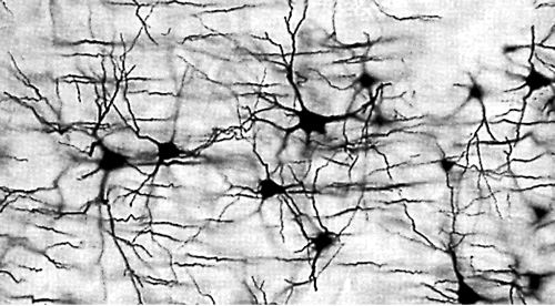 Human Neurons